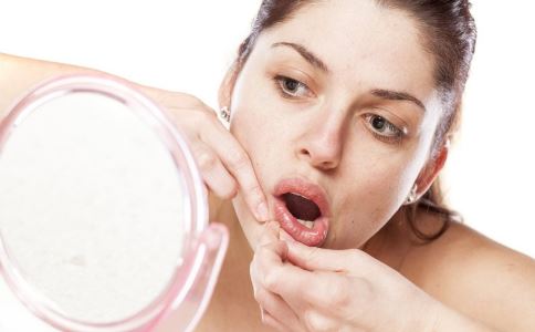 如何祛痘 怎么祛痘好 祛痘的方法有哪些