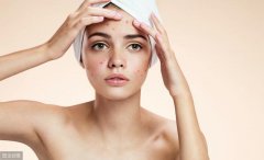 如何解決毛孔粗大 還肌膚白嫩