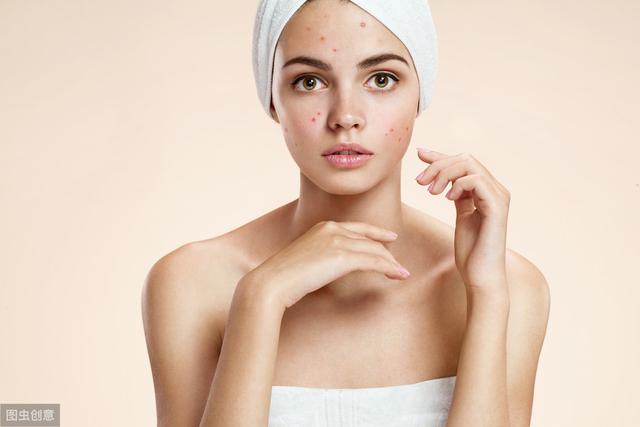 如何避免面部痤瘡問題反復發(fā)作？