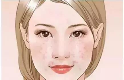 夏季祛痘首先要從正確洗臉開始