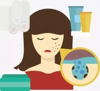 如何區(qū)分痘痘和粉刺？豆尚告訴你