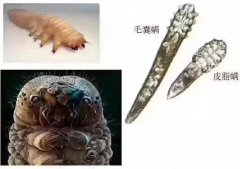 豆尚告你什么是螨蟲？臉上被螨蟲感染都有危害？