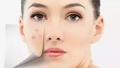 皮膚問題總不好，可能只因你的“螨”不在乎