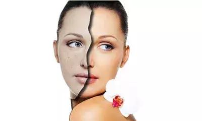 3個美白皮膚的實用小辦法