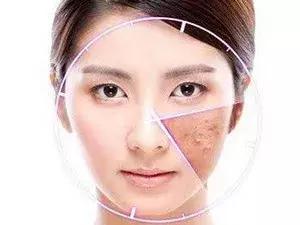 修復(fù)痘印需要注意事項(xiàng)