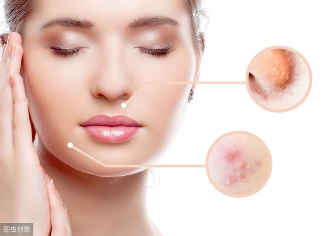 青春痘反反復(fù)復(fù)，快來(lái)了解一下8大祛痘誤區(qū)
