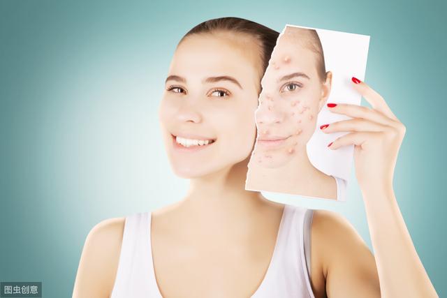 痤瘡可以根治？別再受騙了！豆尚專業(yè)祛痘來告訴你原因