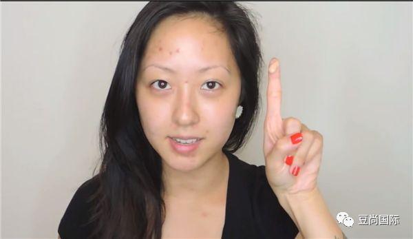 治痘六妙招，讓你的青春不再為痘痘發(fā)愁