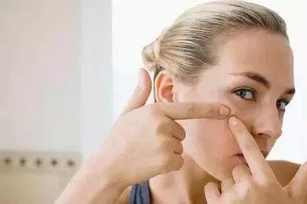 同學(xué)！請管好你的手，青春痘不能隨便擠