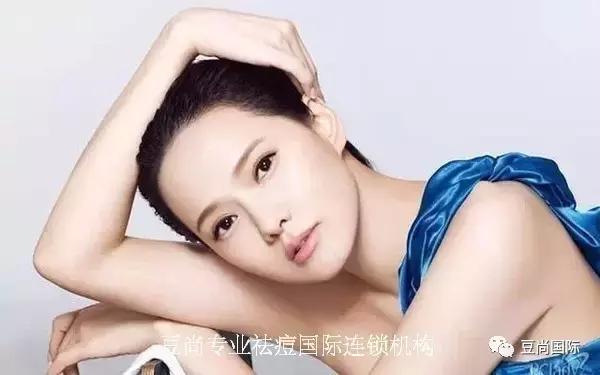 擺脫痘痘后，寫了這篇經(jīng)驗總結(jié)