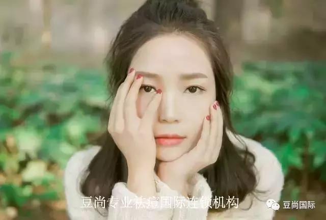 揭秘：如何預(yù)防痘印的產(chǎn)生？