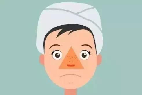 亂擠危險(xiǎn)三角區(qū)的痘痘會(huì)致命？