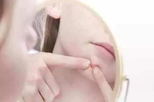 痘痘喜好摧毀，豆尚偏愛修復