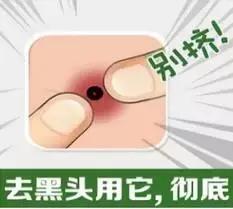 祛黑頭的10個問題答案，原來你是這樣的黑頭