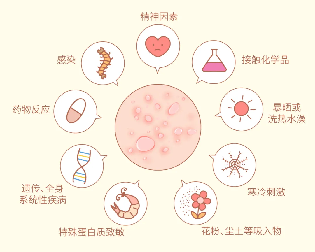 又是一年的過敏高發(fā)季，你將如何應(yīng)對？